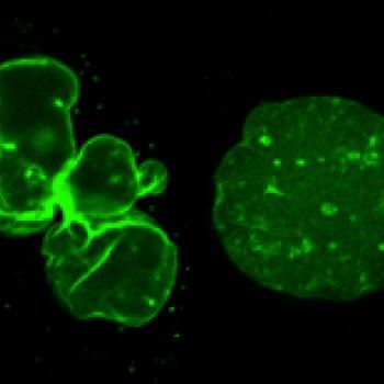 progeria nuclei