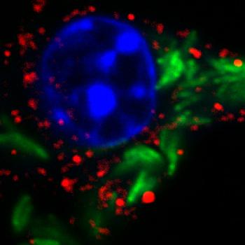 mtbgfp tax1bp1 dapi image