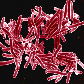 Tuberculosis