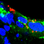 N. gonorrhoeae bacteria (red) penetrate untreated endocervical cells (blue and green)
